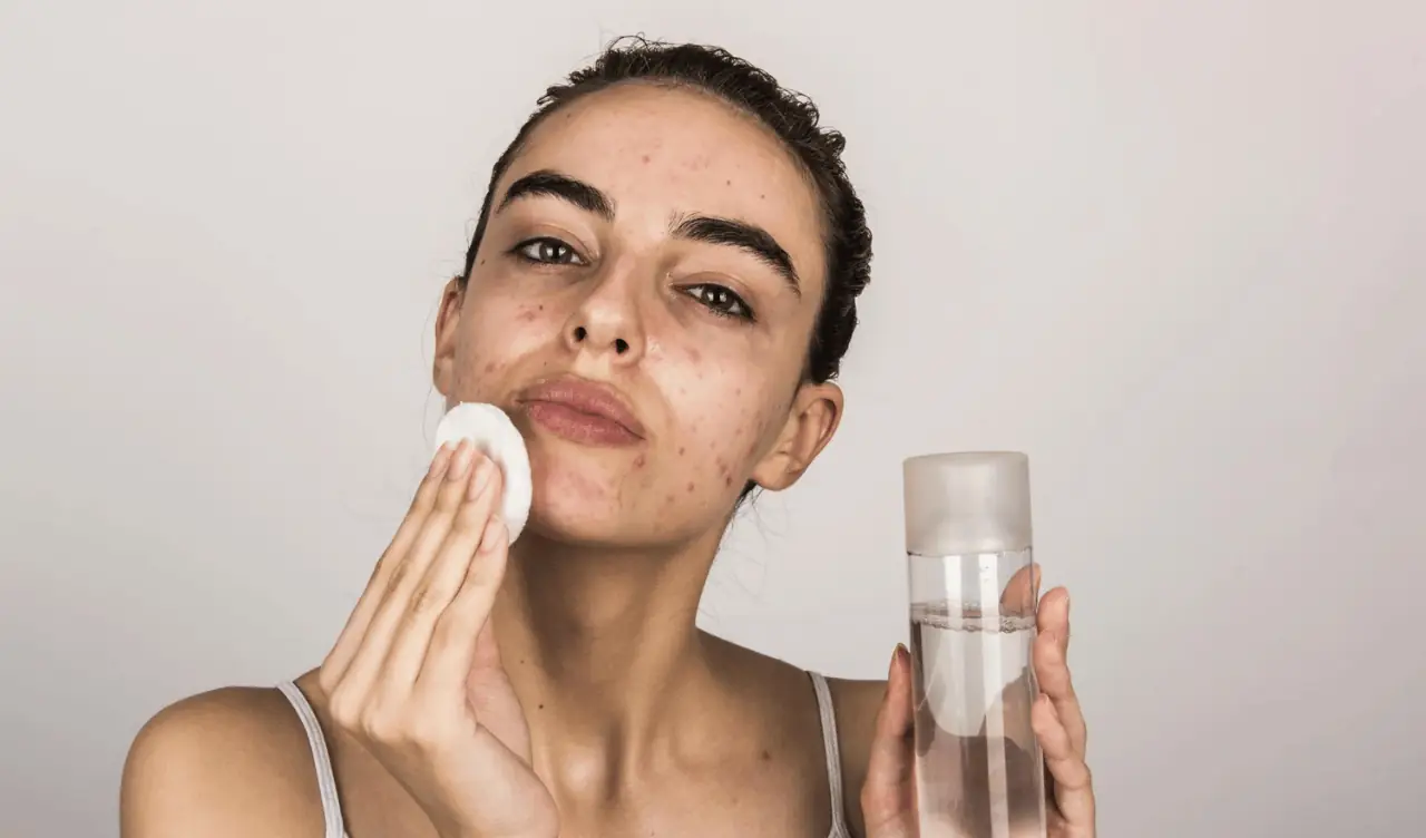 How to Control Oily Skin Without Damaging Your Skin Barrier